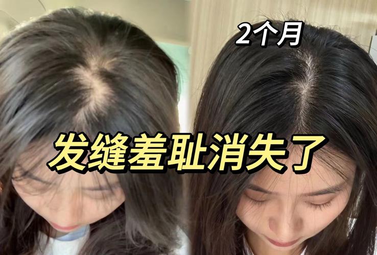 因发量太多剃掉头发,因发量太多剃掉头发会怎么样